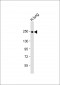 COL14A1 Antibody (Center)